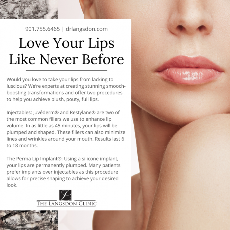 Langsdon-Lip Augmentation (1)